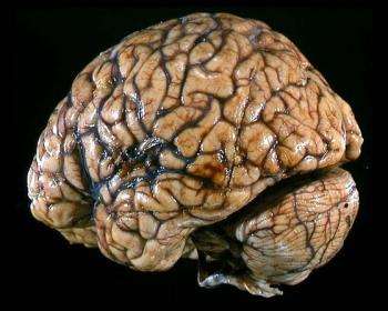 Beyin qırışlarının mənşəyi müəyyənləşdirildi